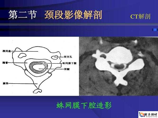 颈腰：突破那层薄膜